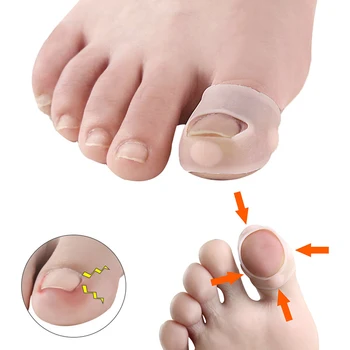 1-6Pair de Silicone Unha Encravada Ferramenta de Correção Invisível Encravada do Dedo do pé de Tratamento de Unhas Elástico Alisamento Clipe Cinta Pedicure